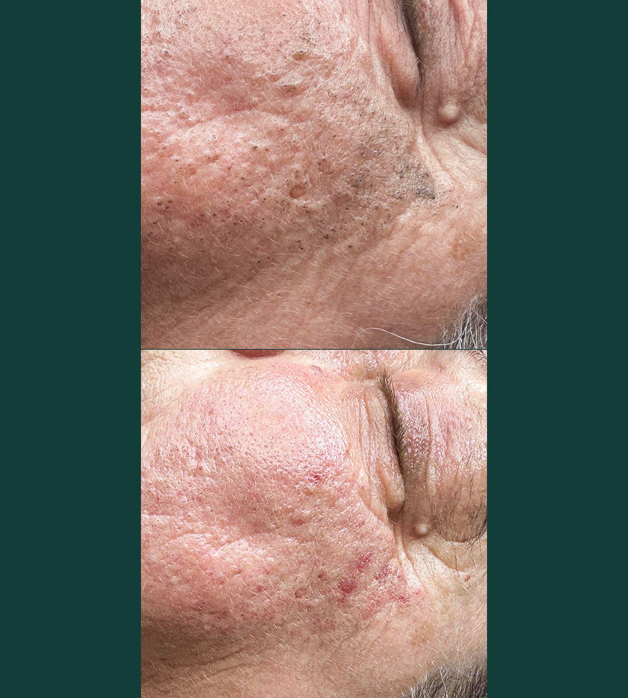 Advanced Skin IS